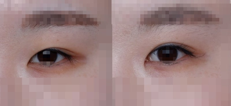 "큰 눈" "또렷한 눈" 에 대하여... 사진 4