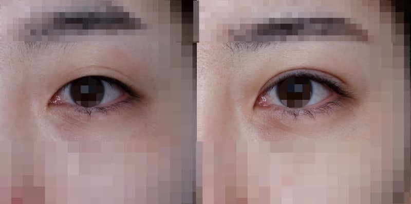 "큰 눈" "또렷한 눈" 에 대하여... 사진 2