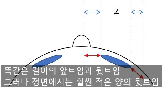 뒤트임, 밑트임에 대하여... 사진 3