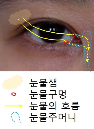 뒤트임, 밑트임에 대하여... 사진 2