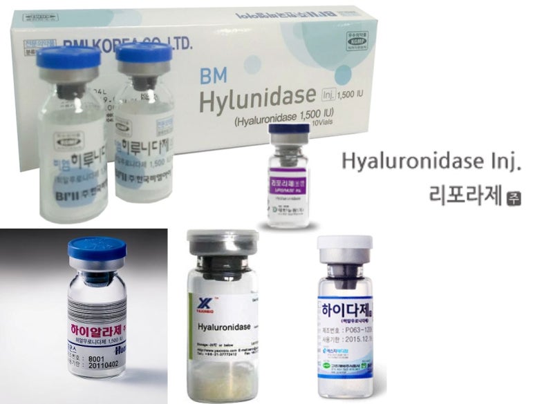 쌍꺼풀수술 후 발생하는 부기 및 관리 사진 4