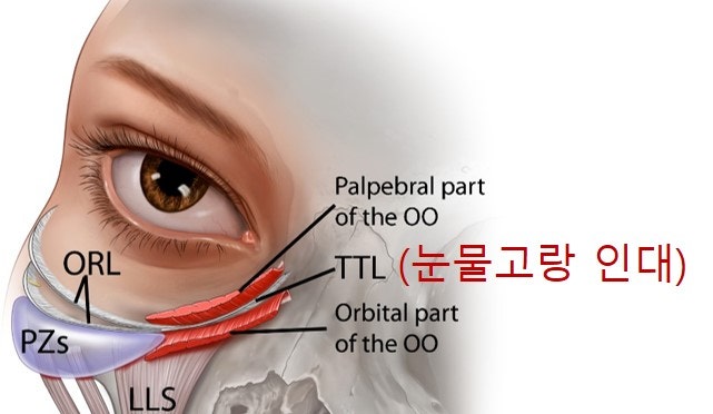 <하안검 1편> 하안검 필러? 지방이식? 에 대하여...