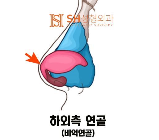 #14 코성형, 코끝 성형 재료, 코 구조부터 알아야 사진 4