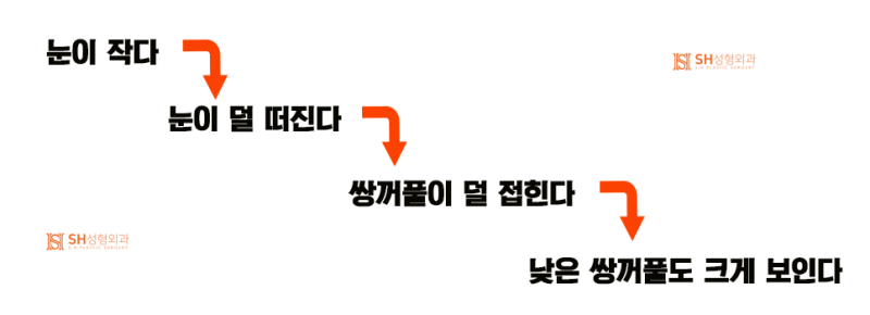 #17 눈매교정 없이 짝눈을 바로잡는 법 — 얼굴디자이너 김성훈 원장의 대칭 디자인 사진 4
