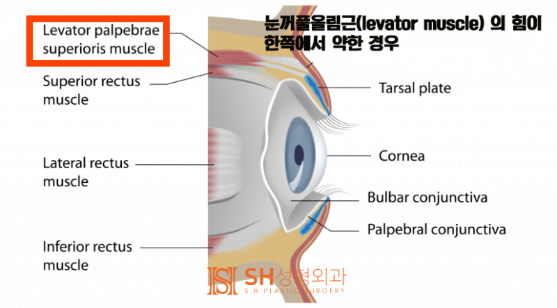 #17 눈매교정 없이 짝눈을 바로잡는 법 — 얼굴디자이너 김성훈 원장의 대칭 디자인