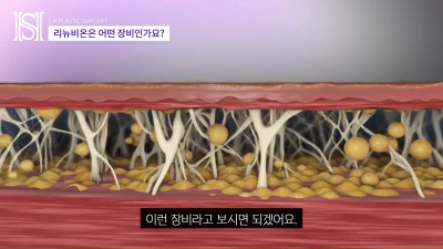 안면윤곽후볼처짐이 고민이라면 윤곽후관리와 처짐리프팅에 리뉴비온! (전후사진있음) 사진 21