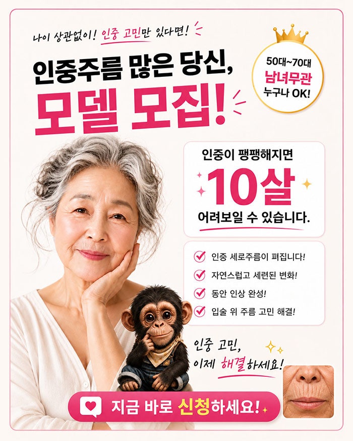 인중세로고양이주름 없애는방법! SH에스에이치성형외과에서 성형모델 모집합니다~ 인중고민 있으신분들 클릭!!