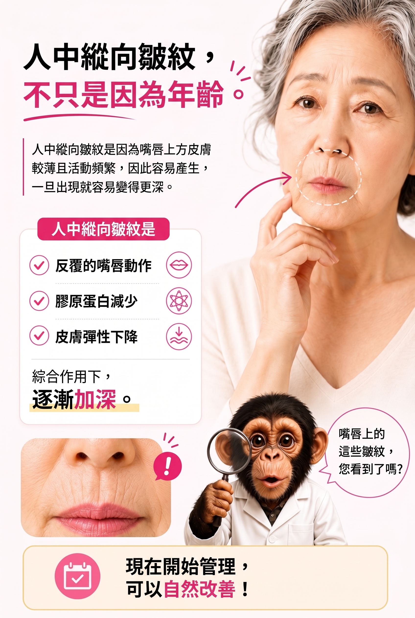消除人中垂直貓咪紋的方法!SH整形外科招募整形模特兒~有人中困擾的請點擊!! 사진 4