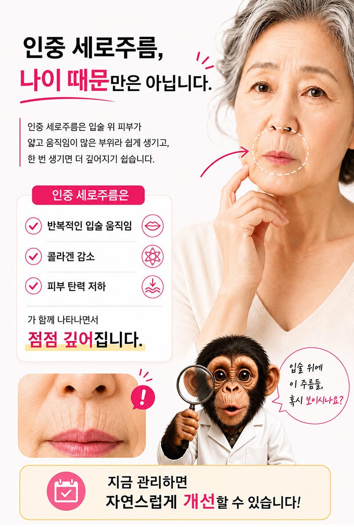 인중세로고양이주름 없애는방법! SH에스에이치성형외과에서 성형모델 모집합니다~ 인중고민 있으신분들 클릭!! 사진 4