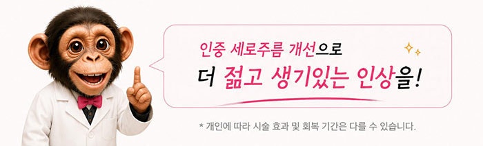 인중세로고양이주름 없애는방법! SH에스에이치성형외과에서 성형모델 모집합니다~ 인중고민 있으신분들 클릭!! 사진 6