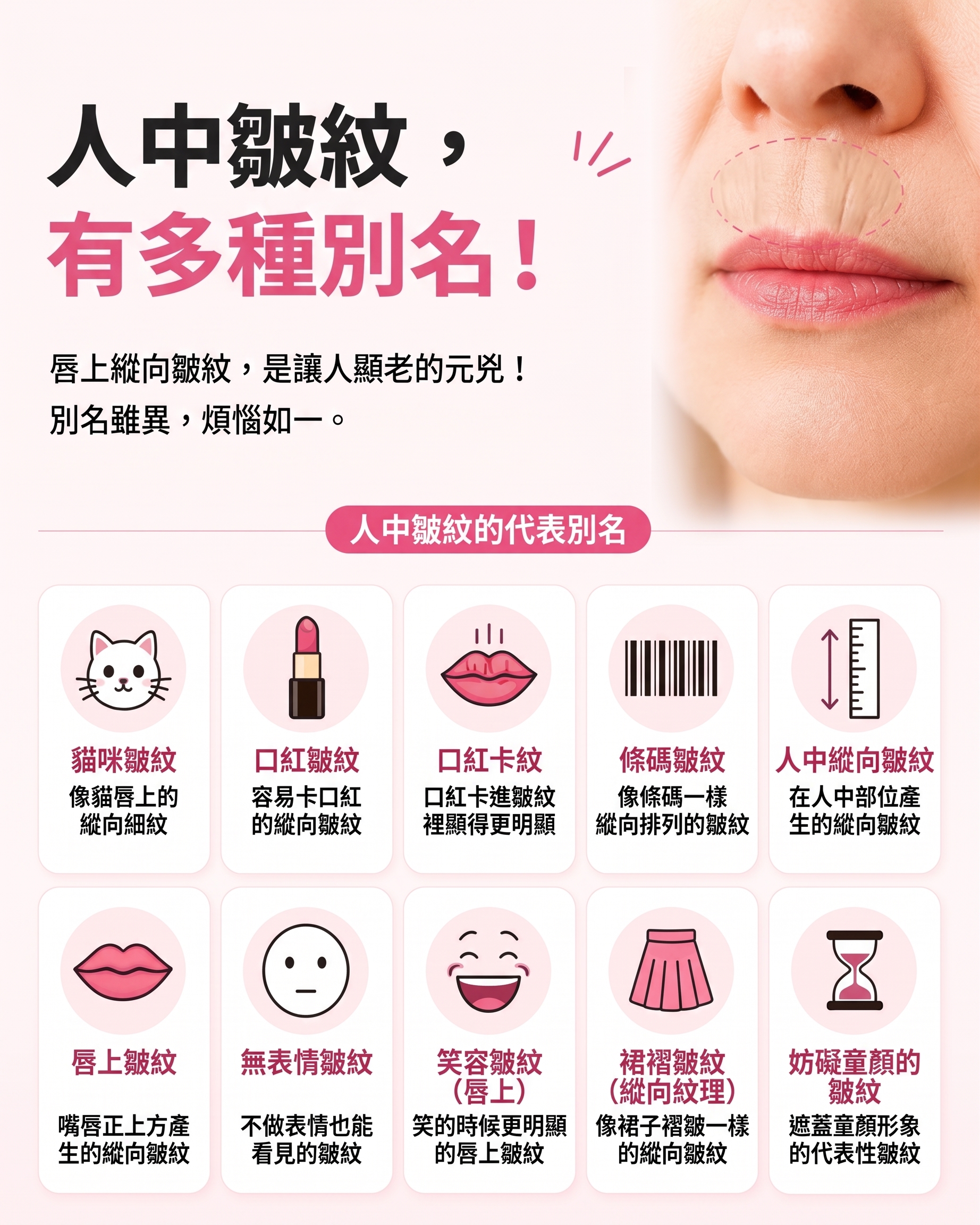 消除人中垂直貓咪紋的方法!SH整形外科招募整形模特兒~有人中困擾的請點擊!! 사진 2