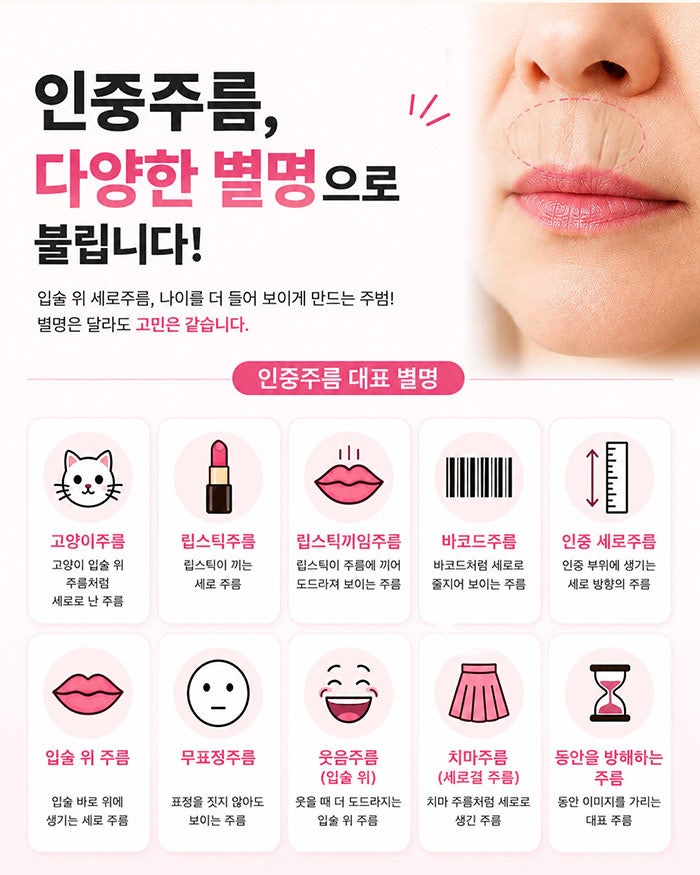 인중세로고양이주름 없애는방법! SH에스에이치성형외과에서 성형모델 모집합니다~ 인중고민 있으신분들 클릭!! 사진 2