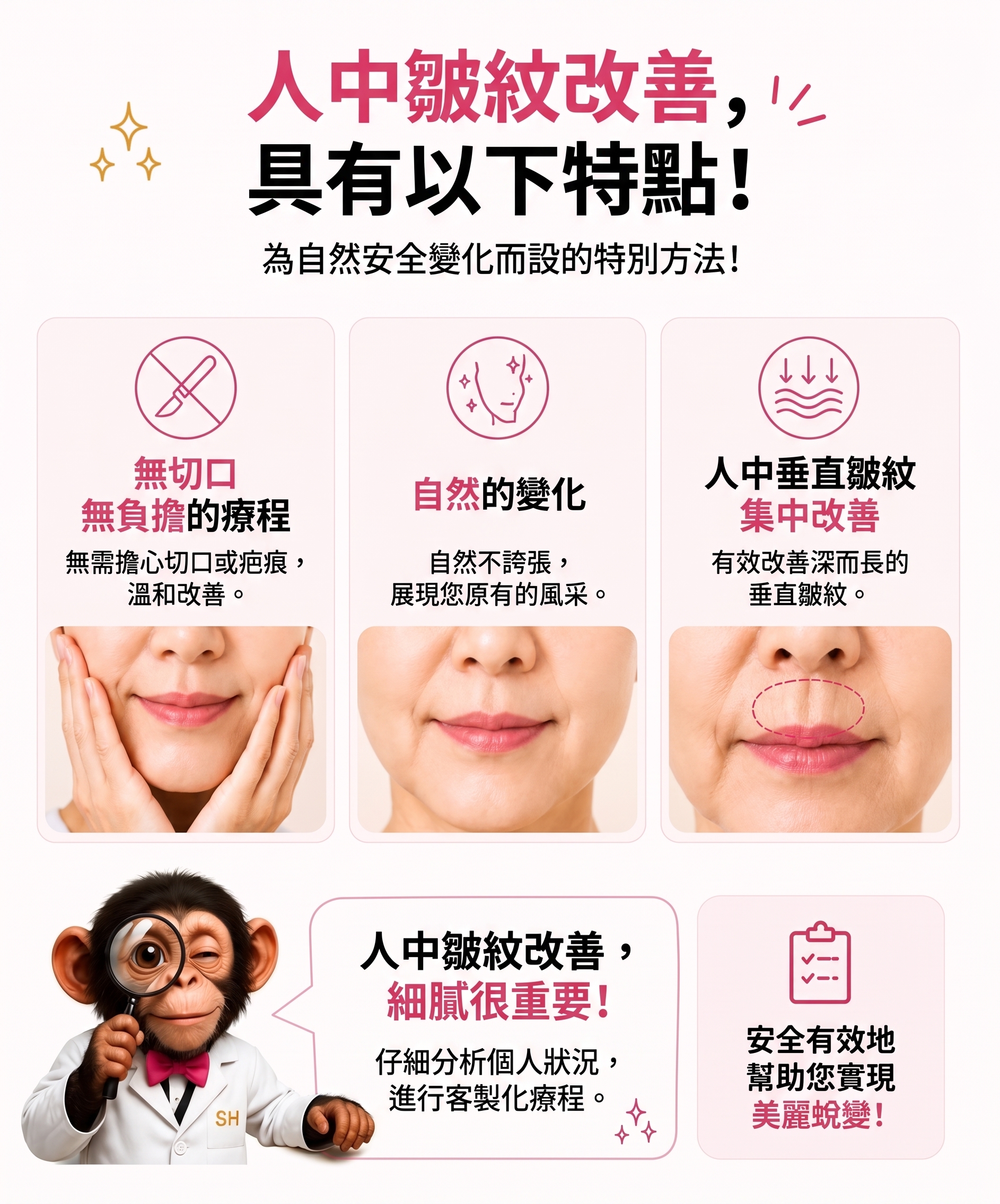 消除人中垂直貓咪紋的方法!SH整形外科招募整形模特兒~有人中困擾的請點擊!! 사진 7