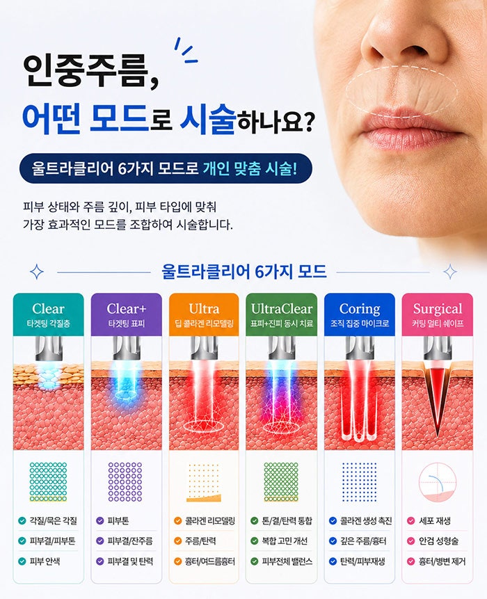 인중세로고양이주름 없애는방법! SH에스에이치성형외과에서 성형모델 모집합니다~ 인중고민 있으신분들 클릭!! 사진 11
