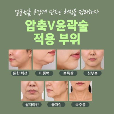 리뉴비온얼굴리프팅 (sh)에스에이치성형외과에서 비절개안면거상 알려드립니다~ 사진 12