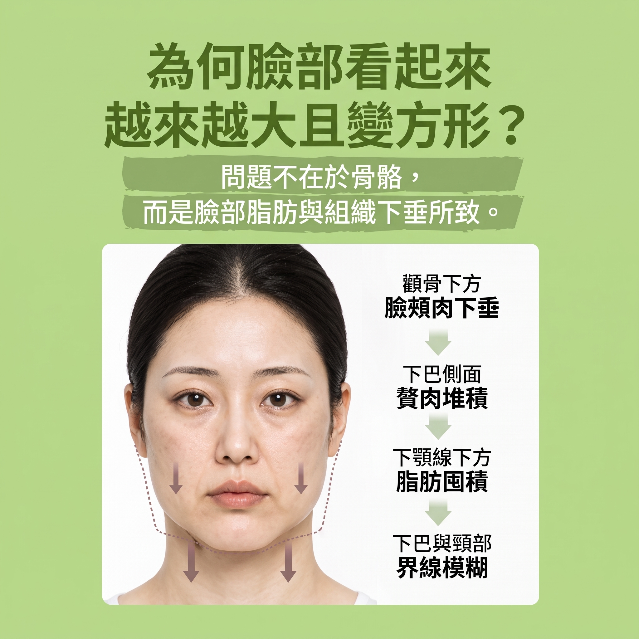 Renuvion臉部拉提 (sh)SH整形外科為您介紹非侵入式臉部拉提術~ 사진 7