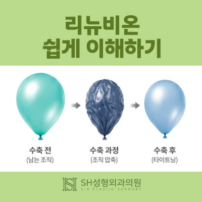 리뉴비온얼굴리프팅 (sh)에스에이치성형외과에서 비절개안면거상 알려드립니다~ 사진 6